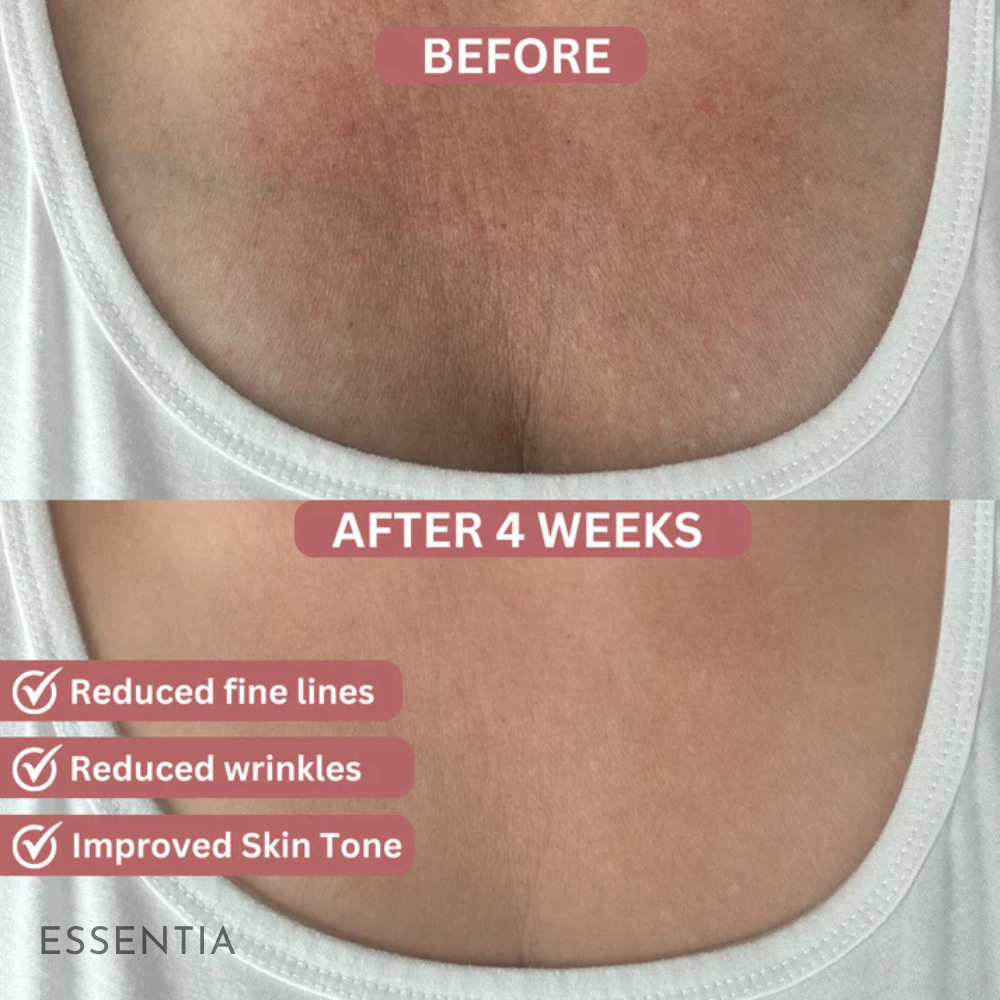 Collagen+ Body Patches