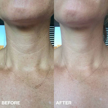 Collagen+ Body Patches