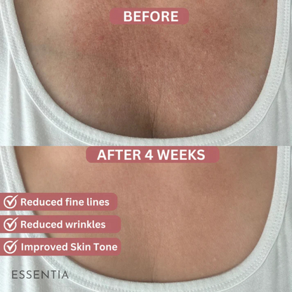 Collagen+ Body Patches
